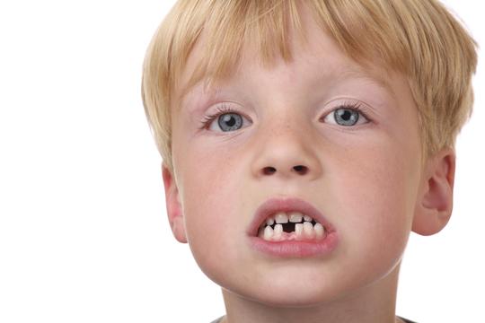 dječak bez zuba zubi