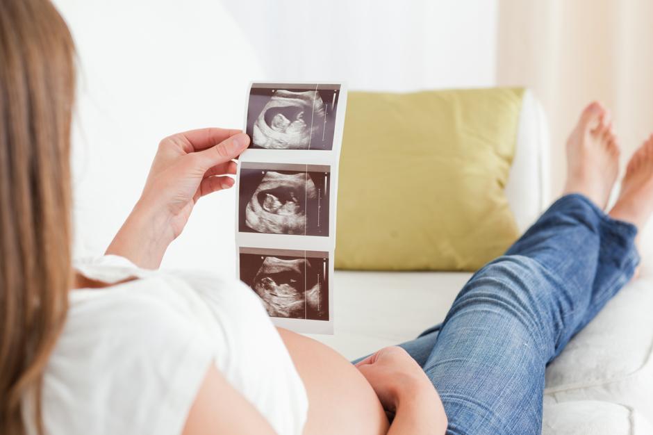 trudnoća trudnica | Author: Thinkstock
