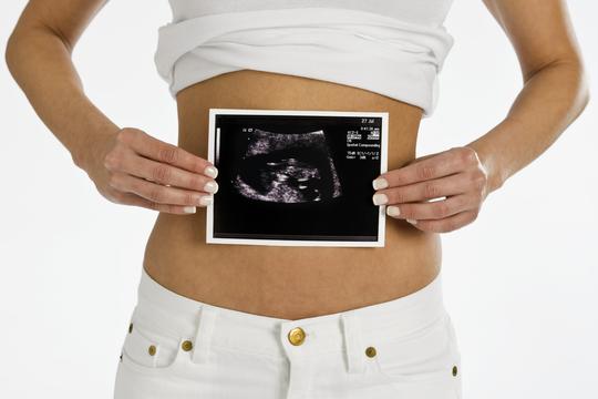 ultrazvuk, trudnica