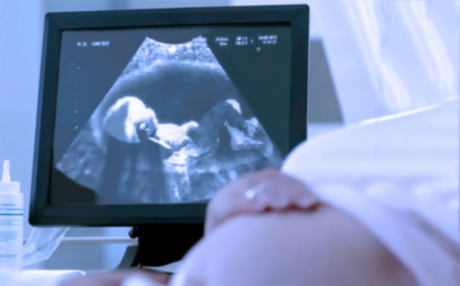 UZV u trudnoći | Author: Shutterstock